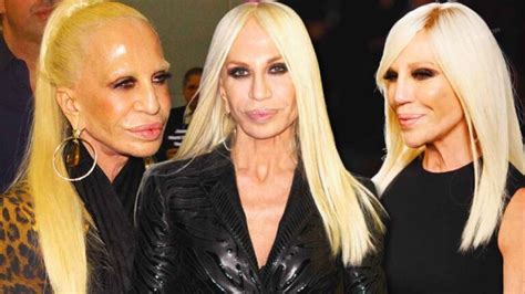 donatella versace son histoire|what happened to donatella versace's face.